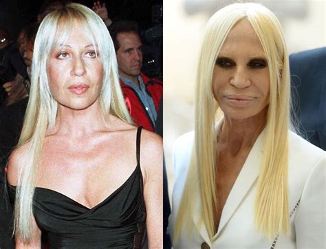 donatella versace before after surgery|donatella versace without make up.